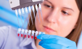 Researchers Find New Biomarkers for Severe Lupus Nephritis
