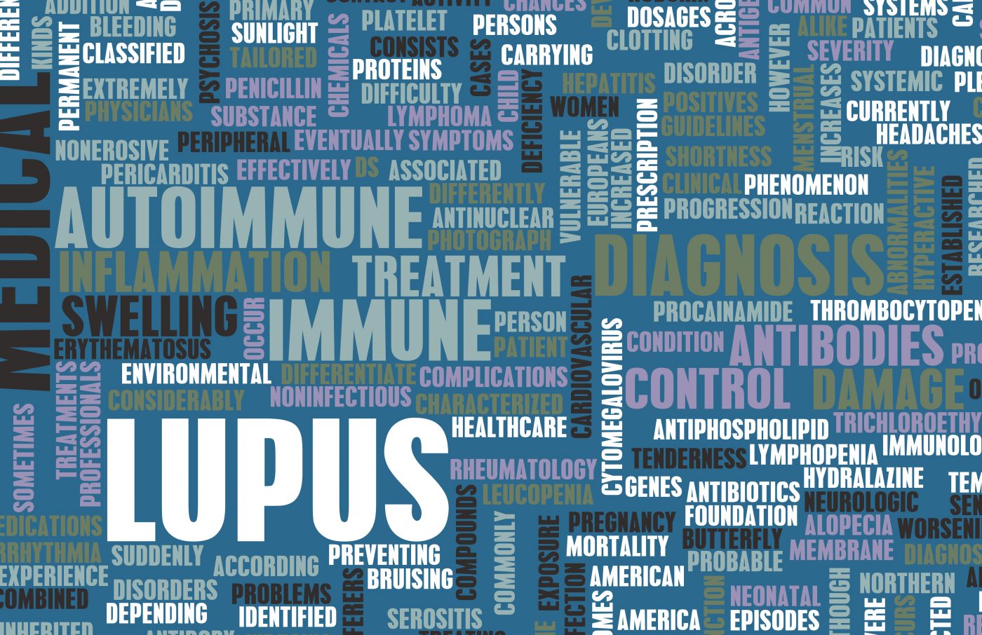 Systemic Lupus Erythematous Patients Prone to Higher Cardiovascular Disease Rates