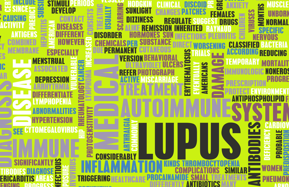 LFAREAL Identified As New Test to Measure Lupus Severity