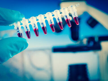 SLE therapy