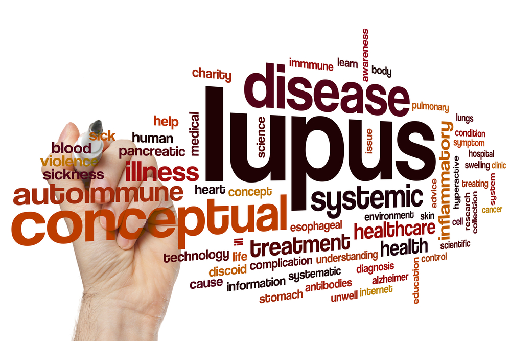 lupus analysis of treatment