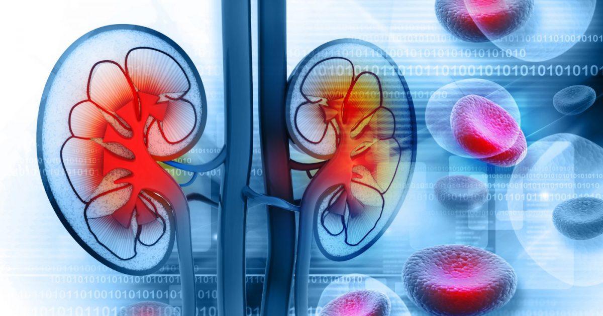 Urine of Lupus Patients with Renal Failure May Carry Disease Biomarker