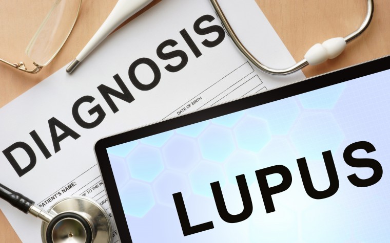 lupus case study