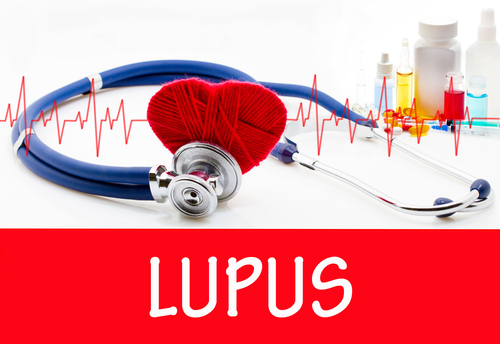 Lupus Treatment Lupus News Today