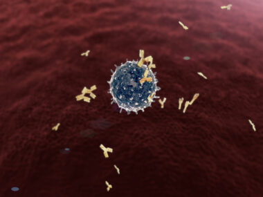 thrombotic antiphospholipid syndrome