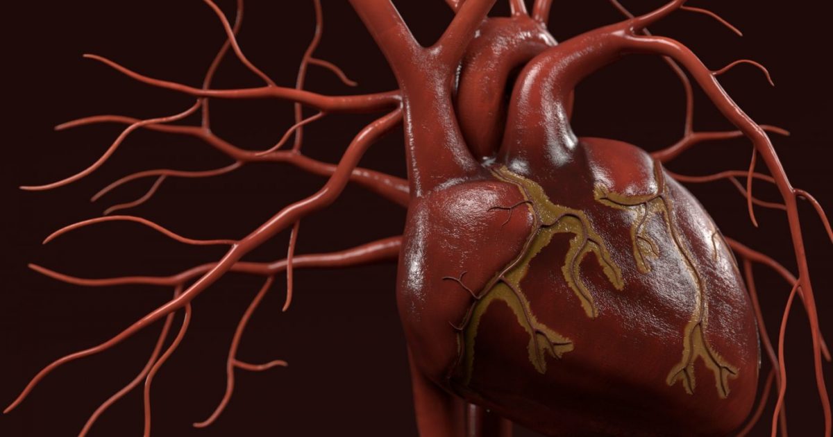Lupus Myocarditis Outcomes Generally Positive in SLE patients, Study Finds