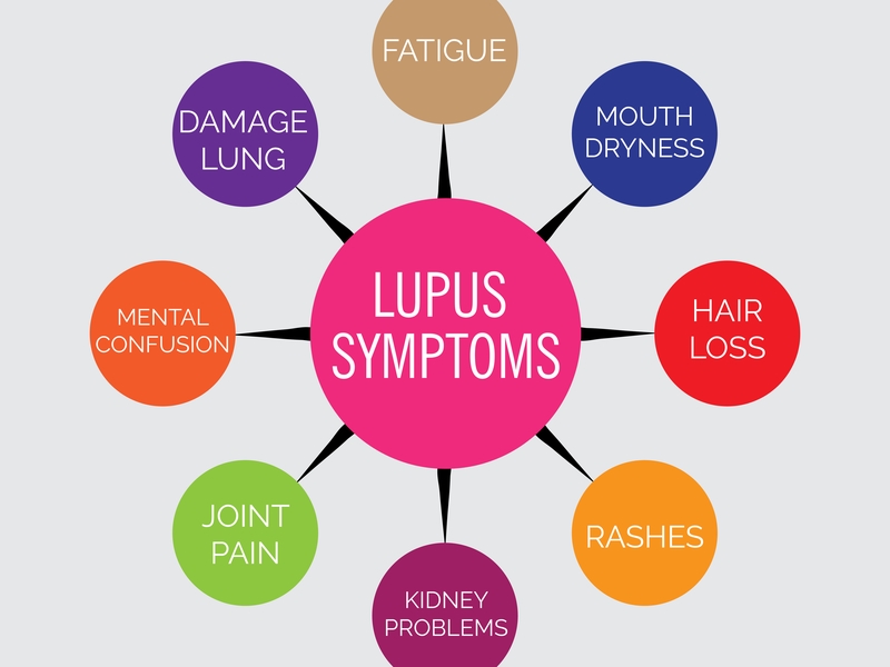 Lupus without a partner