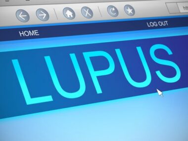 lupus, UV light