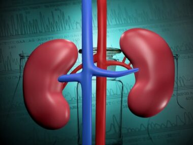 PTX3 Lupus Nephritis