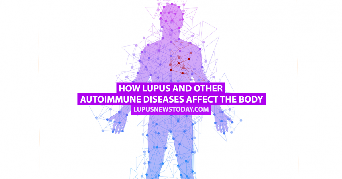 How Lupus And Other Autoimmune Diseases Affect The Body | Lupus News Today