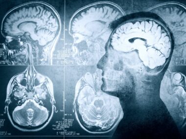 magnetic imaging scans