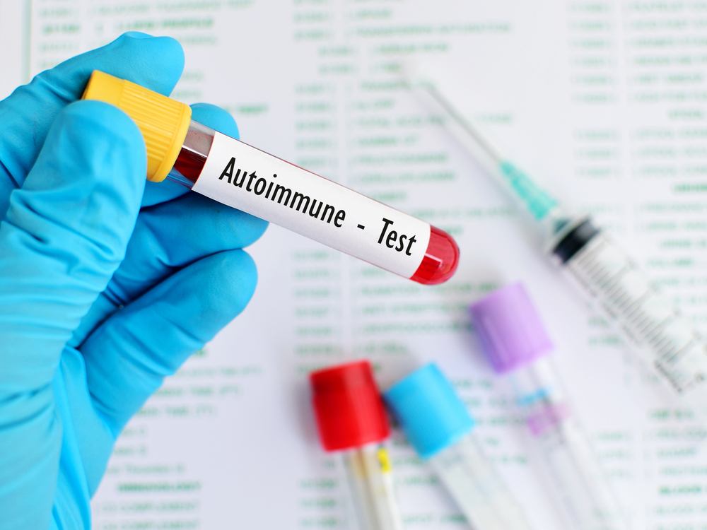autoantibodies identify at-risk patients