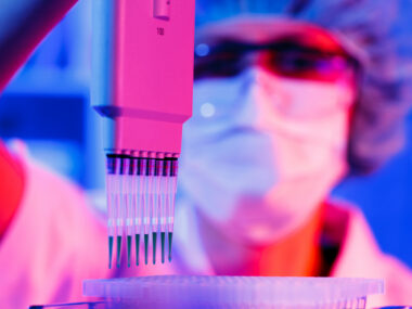 Cancer immunotherapy and lupus