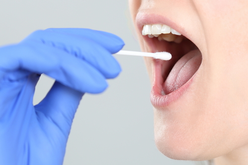 A Saliva Test to Diagnose Lupus May Soon Become a Reality