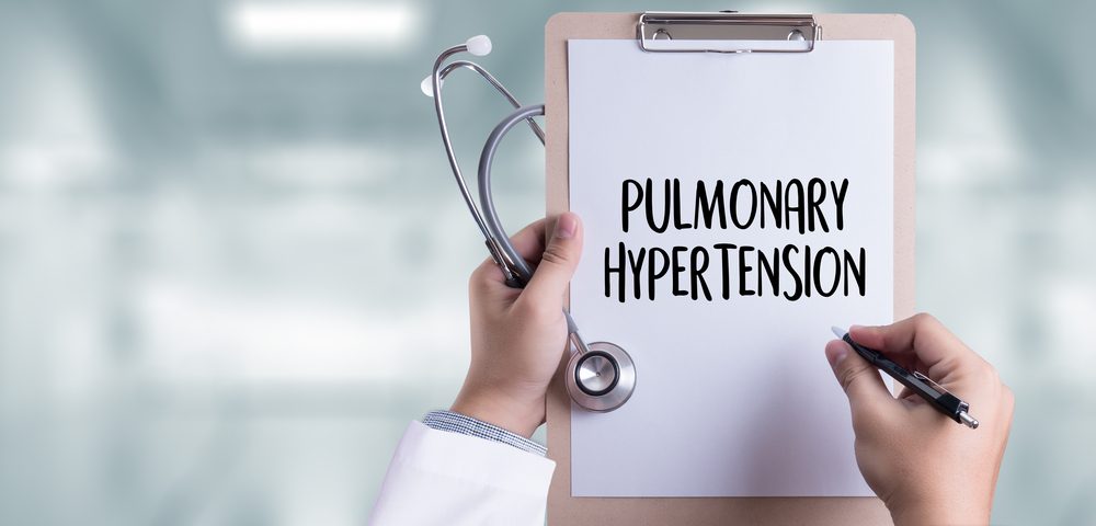 Pulmonary Hypertension More Common in Adult Male Lupus Patients, New Study Shows