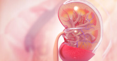 lupus nephritis, renal arteriosclerosis
