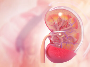 lupus nephritis, renal arteriosclerosis