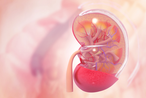 Nephrotic Syndrome Reduces Chances of Kidney Recovery in People with Lupus Nephritis, Study Says