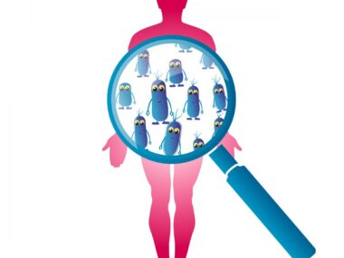 testosterone levels and lupus