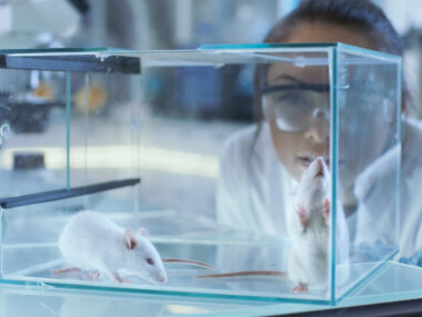 CAR T cells and lupus