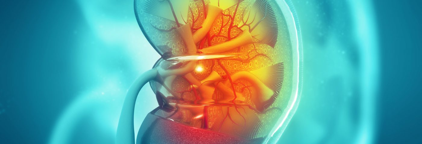 Gazyva Combo Helps Lupus Nephritis Patients Achieve Response, Trial Data Show