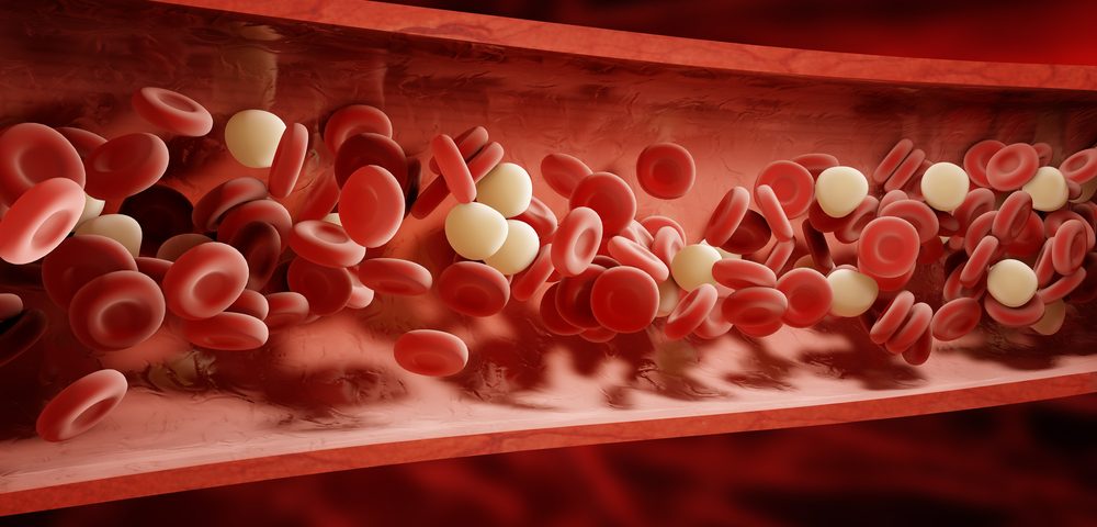 Blood Protein Levels Linked to Disease Activity in Children with SLE and May Be Biomarkers, Study Reports
