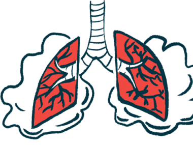 Illustration of lungs.