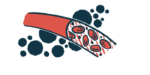 A blood vessel is shown in this illustration.