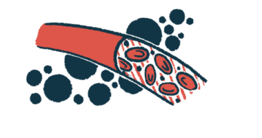 A blood vessel is shown in this illustration.