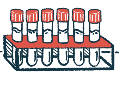 An illustration shows a row of vials in a rack.